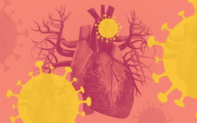 Người mắc bệnh tim mạch cần làm gì để bảo vệ mình trong dịch Covid-19?