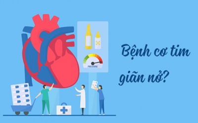 Bệnh cơ tim giãn nở là gì, có triệu chứng gì cảnh báo?