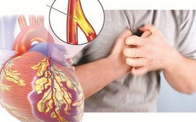 Nhịp tim nhanh kèm cầu cơ mạch vành dùng Ninh Tâm Vương được không?