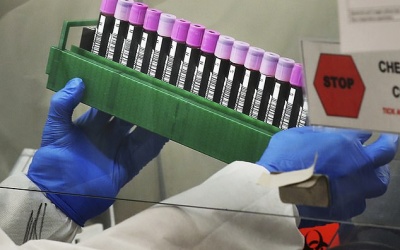 Robot có thể giúp thực hiện 3.000 xét nghiệm Covid-19/ngày