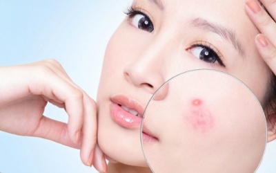 Các vitamin và khoáng chất giúp chăm sóc da, trị mụn hiệu quả