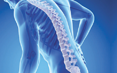 Những thói quen không tốt có thể khiến bạn bị loãng xương