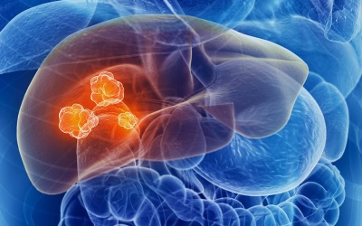 Uống cà phê giúp giảm nguy cơ mắc ung thư gan lên tới 50%