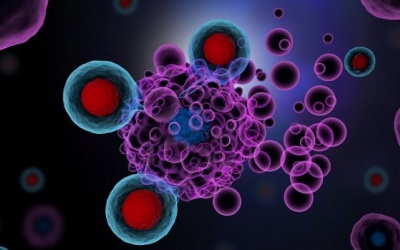 Điều trị ung thư buồng trứng bằng liệu pháp miễn dịch có hiệu quả?