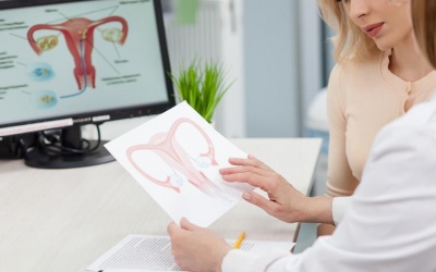 Rong kinh do u xơ tử cung và cách cải thiện hiệu quả