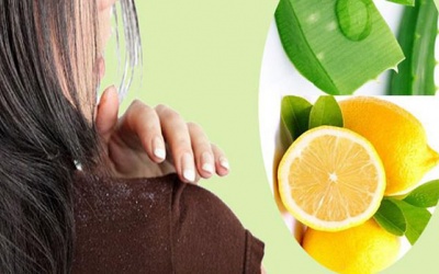 “Đánh bay” gàu bằng chanh tại nhà cực đơn giản