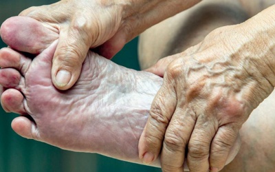 Mắc đái tháo đường: Cần chú ý chăm sóc bàn chân thường xuyên hơn