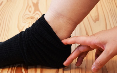 Hay thấy vết hằn khi đi tất: Cẩn thận với một số tình trạng sau