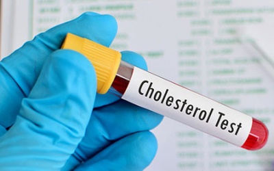 Chỉ số mỡ máu thế nào là nguy hiểm?