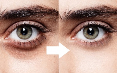 Quầng thâm mắt: Nguyên nhân và cách khắc phục? 