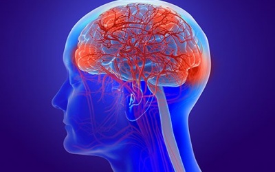 Tăng huyết áp và đái tháo đường làm suy giảm chức năng não bộ