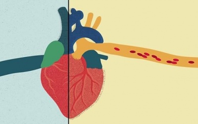 Những nguyên nhân gây suy tim phải bạn nên cảnh giác