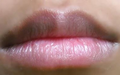 6 thói quen khắc phục môi thâm hiệu quả tại nhà