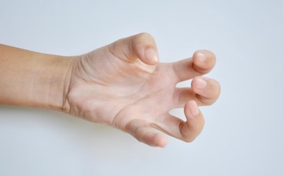 Run do rối loạn trương lực cơ là gì, triệu chứng, cách điều trị?