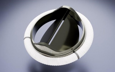 Van tim cơ học là gì, có ưu, nhược điểm thế nào?