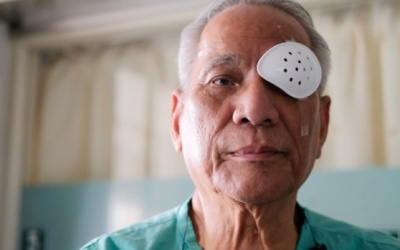 Cần kiêng gì sau phẫu thuật đục thủy tinh thể?