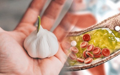 Thực phẩm giúp hạ cholesterol, phòng ngừa đau tim, đột quỵ