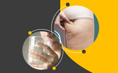 Làm sao khắc phục tình trạng da sần vỏ cam ở đùi?