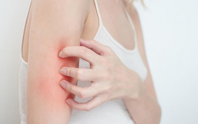 Khi bị dị ứng thức ăn phải làm sao?