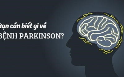 Tổng quan về bệnh Parkinson: Nguyên nhân, triệu chứng và cách điều trị