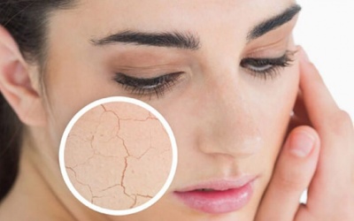 Bí kíp “đánh bại” các vấn đề về da vào mùa đông 