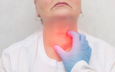 Sưng cổ, tim đập nhanh có thể là triệu chứng của cường giáp