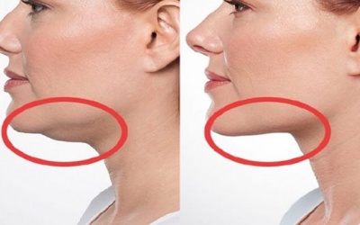 'Bí kíp” sở hữu khuôn mặt V-line không cần phẫu thuật