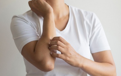 Ngứa da ở cánh tay, chân có phải biến chứng đái tháo đường?