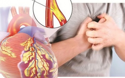 Thừa cân, béo phì ảnh hưởng đến tim như thế nào?