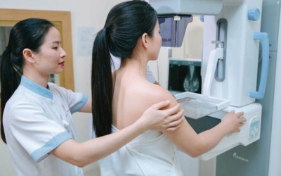 Ung thư vú dần 'trẻ hóa': Tầm soát ngay trước khi quá muộn!