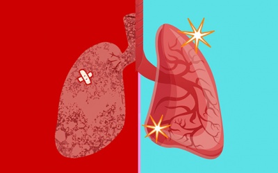 Chất lượng không khí kém: 6 cách đơn giản làm sạch, giải độc phổi