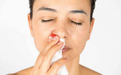 Chảy máu cam thường xuyên là dấu hiệu của bệnh gì?