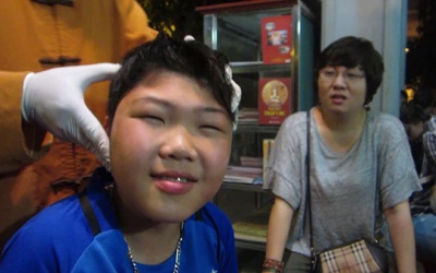 Người bị động kinh ăn gì tốt?