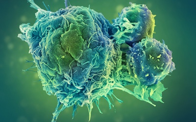 Liệu pháp miễn dịch điều trị ung thư - Dấu ấn hành trình 25 năm của MSD tại Việt Nam