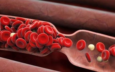 Bí quyết làm sạch “rác” trong mạch máu đơn giản