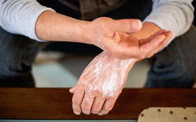 Cách phòng ngừa bệnh vảy nến tái phát vào mùa Đông