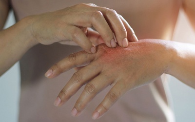 4 thay đổi trên da có thể cảnh báo bệnh đái tháo đường