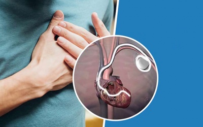 Một vài điều cần biết khi thực hiện liệu pháp tái đồng bộ tim