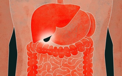 Liệu có thể sống bình thường sau khi cắt bỏ túi mật?