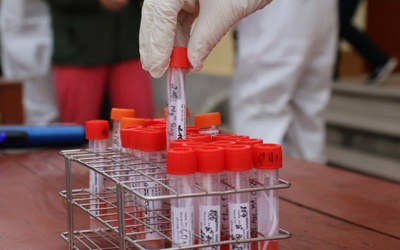 Tìm ra F0 của chùm lây nhiễm trong cùng một gia đình ở Hải Dương