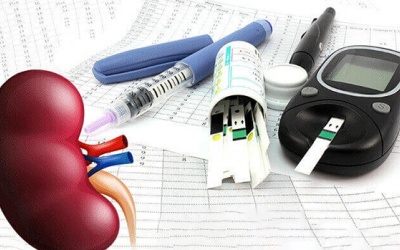 Đái tháo đường type 2, creatinine 41mmol/L đã bị biến chứng thận chưa?