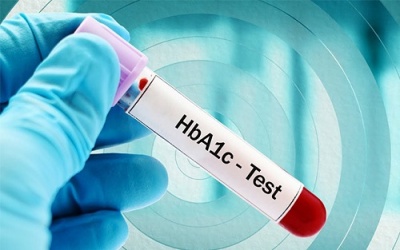 HbA1c 8.5% có nguy hiểm không?