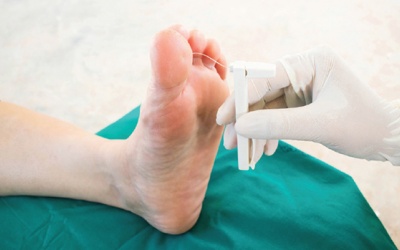 Làm sao để vết thương ở người bệnh đái tháo đường nhanh lành?