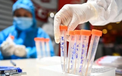 Một người ở Hà Nội dương tính với SARS-CoV-2, là F1 của ca ở Hà Nam