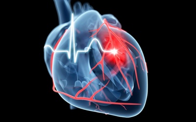 Tiền đái tháo đường cũng có thể làm tăng nguy cơ đau tim, đột quỵ