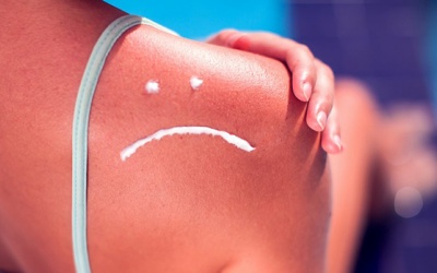 Làm thế nào để phục hồi làn da cháy nắng?