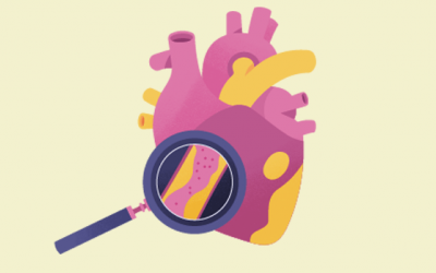 Tại sao cần điều trị sớm máu nhiễm mỡ?