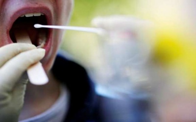 Khô miệng, ngứa lưỡi có thể là triệu chứng mới cảnh báo COVID-19?