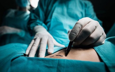 Mổ polyp túi mật có nguy hiểm không, khi nào cần thực hiện?