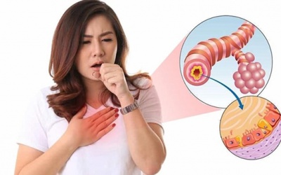 Cải thiện ho, khó thở do viêm phế quản bằng sản phẩm thiên nhiên 